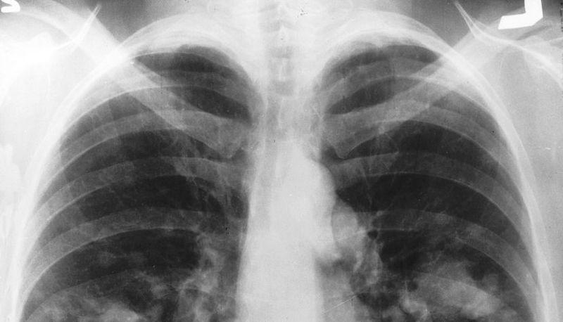 Simulazione della respirazione polmonare in laboratorio di biologia articolo