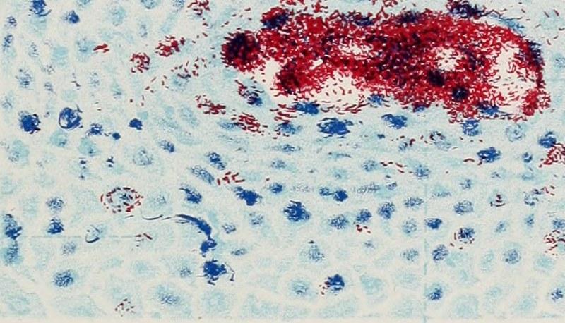 Louis Pasteur: uno dei padri della microbiologia articolo