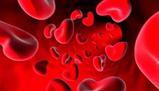Comprendere e prevenire l'anemia mediterranea e le microcitemie