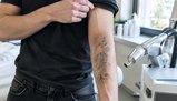 Cancellare un tatuaggio non significa farlo sparire: cosa accade davvero all'inchiostro sotto la pelle