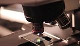 Muffe al microscopio: caratteristiche, immagini e struttura delle spore