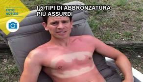 5 tipi di abbronzatura assurdi che ti faranno ridere fino alle lacrime