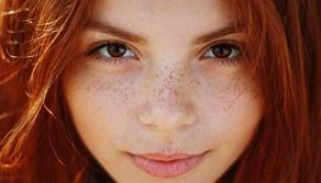 Arriva il freckling, lentiggini tatuate che sembrano vere