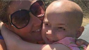 Bimba bullizzata perde tutti i capelli per lo stress