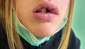 14enne pestata a scuola per le sigarette, interviene la madre e viene aggredita anche lei