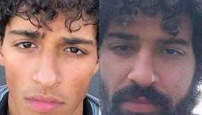 'Effetto Waterloo', l'invecchiamento precoce che colpisce gli studenti di Ingegneria esiste: le immagini parlano da sole