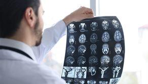 L'adolescenza finisce dopo i 30 anni: lo studio del cervello mostra quando iniziano le 5 'ere' della vita dell'uomo