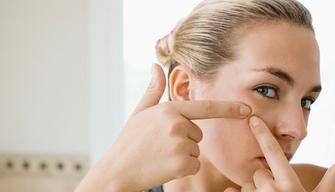 5 cose che chi odia i brufoli può capire