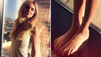 I piedoni di Chiara Ferragni fanno impazzire il web