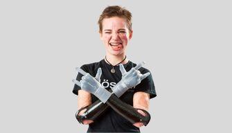 Che scuola ha fatto Bebe Vio?