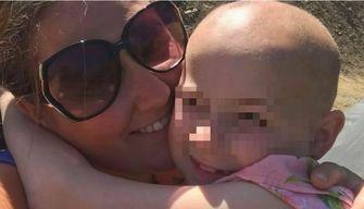 Bimba bullizzata perde tutti i capelli per lo stress