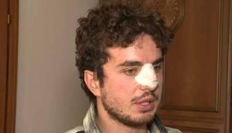 Il professore picchiato a scuola sugli aggressori: "Vorrei parlare con loro e cercare di capire"