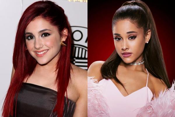 20 Star di Hollywood che sono cambiate tantissimo in soli 5 anni!